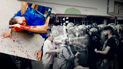 Cover Image for الأمن يتدخل بقوة ويسيل دماء المتظاهرين في مسيرة احتجاجية بمدينة العروي