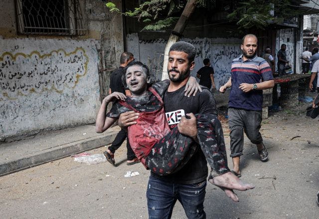 Cover Image for هيئات أممية مجمعة على هول جرائم الحرب المرتكبة في غزة